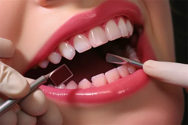 专家推荐的种植牙方法