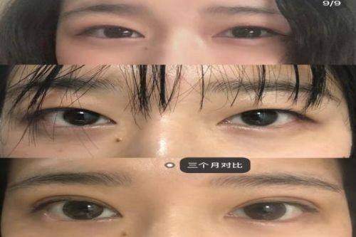 隆胸项目满足多样需求