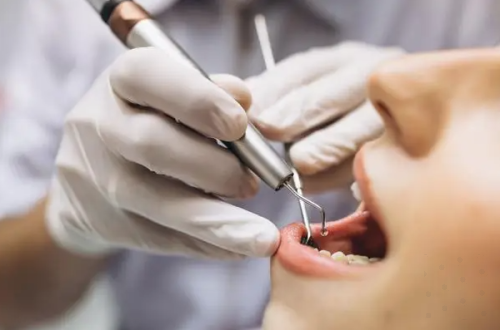 广州广大口腔（荔湾院区）熊含颖牙齿矫正：原价19800元元起，现优惠价低至9800元起！