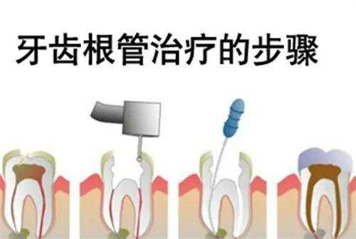 三大核心优势,解决患者后顾之忧