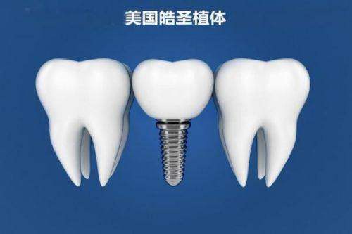 漯河众植口腔刘坤鹏医生种植牙：原价8800元起，现优惠价低至5999元起！