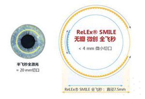 想摆脱眼镜困扰？江西新视界宁财文医生分享近视手术体验及恢复全过程！