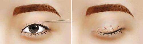 晋安白天鹅医疗美容门诊部实力雄厚