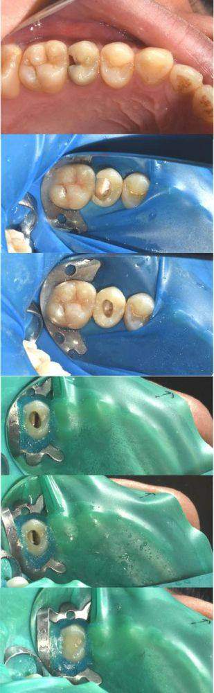 标准化诊疗流程,步步精细可控