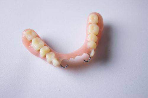 漯河缺牙老人的福音：陈峻岭医生活动义齿让晚年生活有滋有味