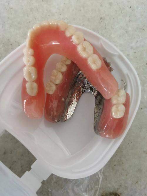 半口/全口吸附性活动义齿:高龄患者福音