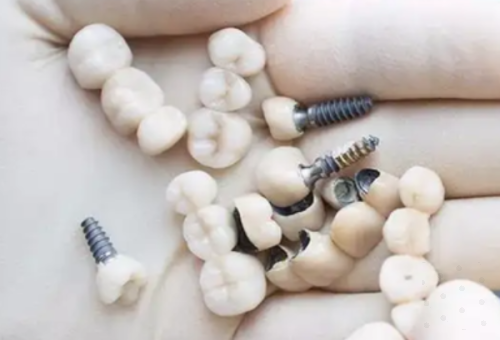 深圳爱康健口腔医院2025年价格表