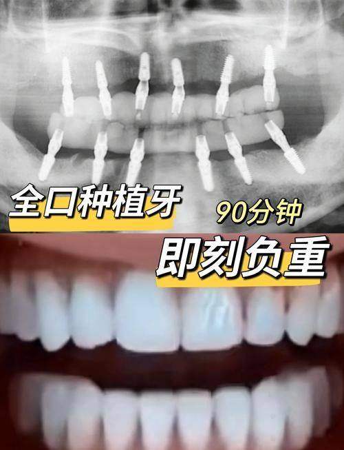 深圳爱康健口腔医院13家分院公交、地铁路线全攻略，含地址、收费及正畸科普