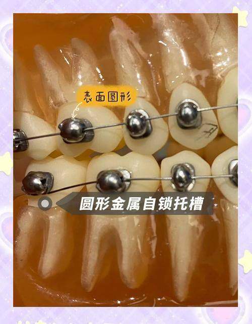 前往深圳爱康健口腔医院的温馨提示