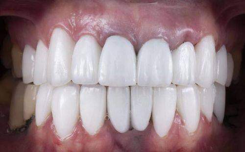 深圳爱康健口腔医院有急诊吗？港资背景、种植牙质保10年。